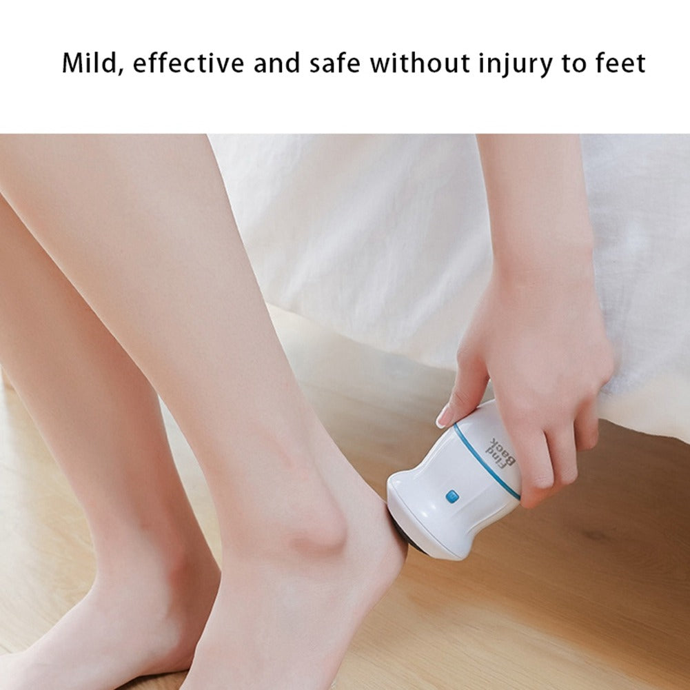 Electric Back Callus Remover with Built-In Vacuum – Rechargeable Foot Grinder for Dead Skin