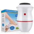 Electric Back Callus Remover with Built-In Vacuum – Rechargeable Foot Grinder for Dead Skin