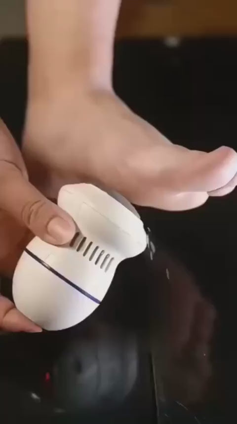 Electric Back Callus Remover with Built-In Vacuum – Rechargeable Foot Grinder for Dead Skin