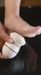 Electric Back Callus Remover with Built-In Vacuum – Rechargeable Foot Grinder for Dead Skin